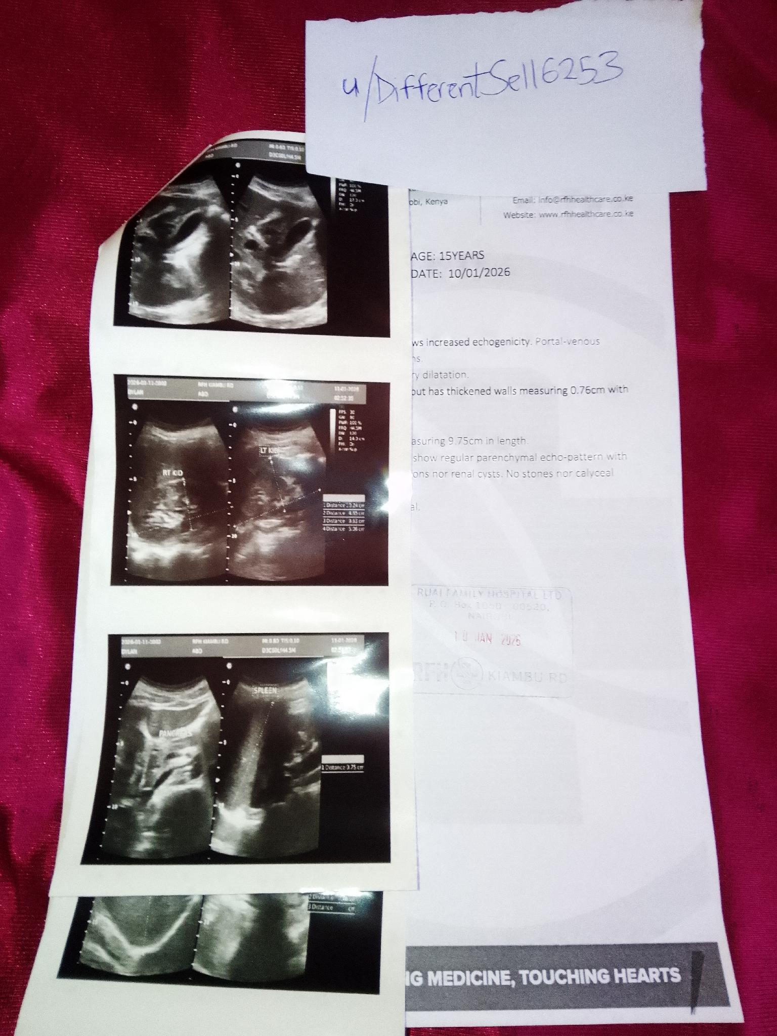 Medical contribution for my little brother. His name is Dylan Nyumu.-1768474555310