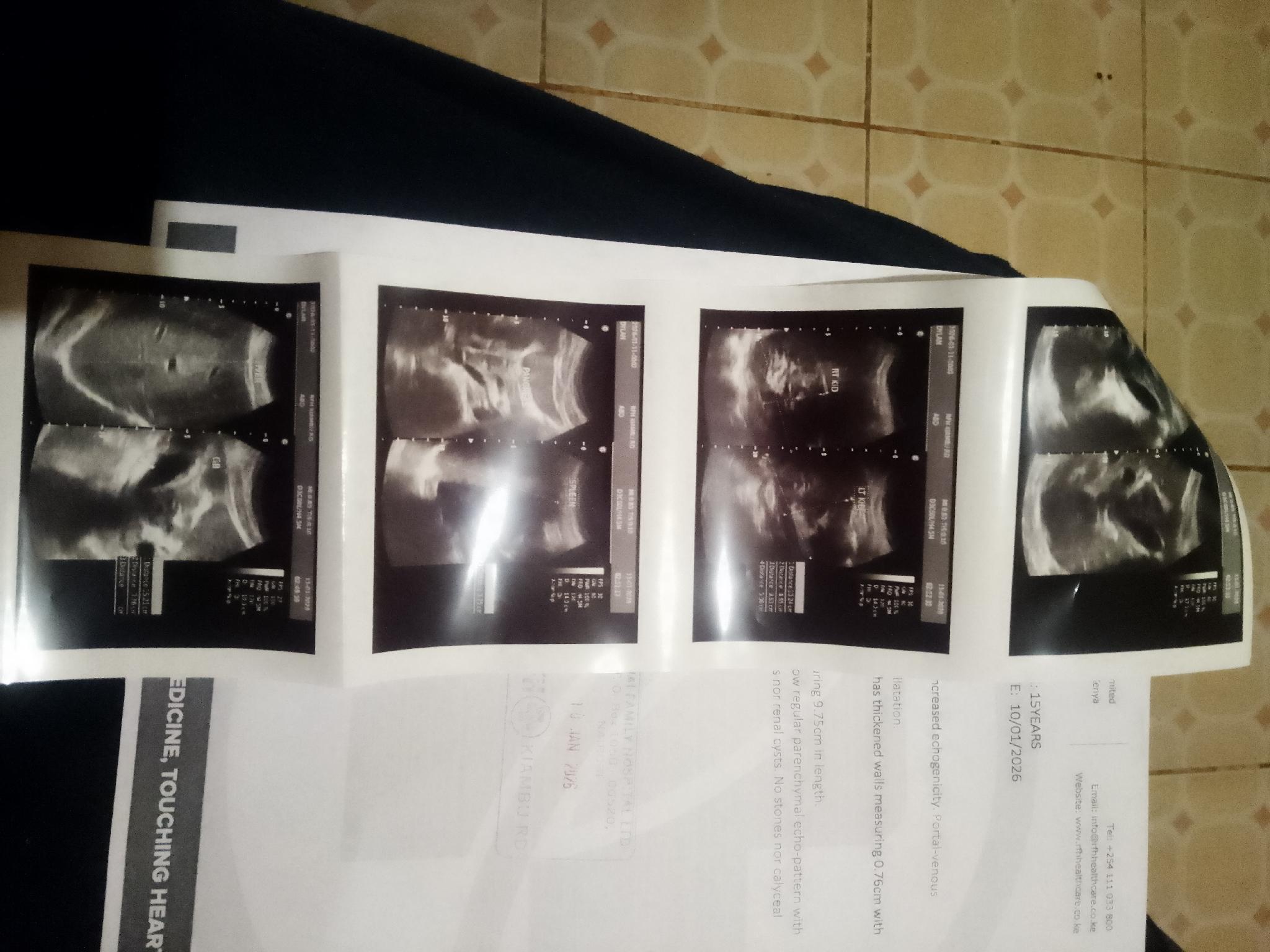 Medical contribution for my sick little brother.-1771352791416